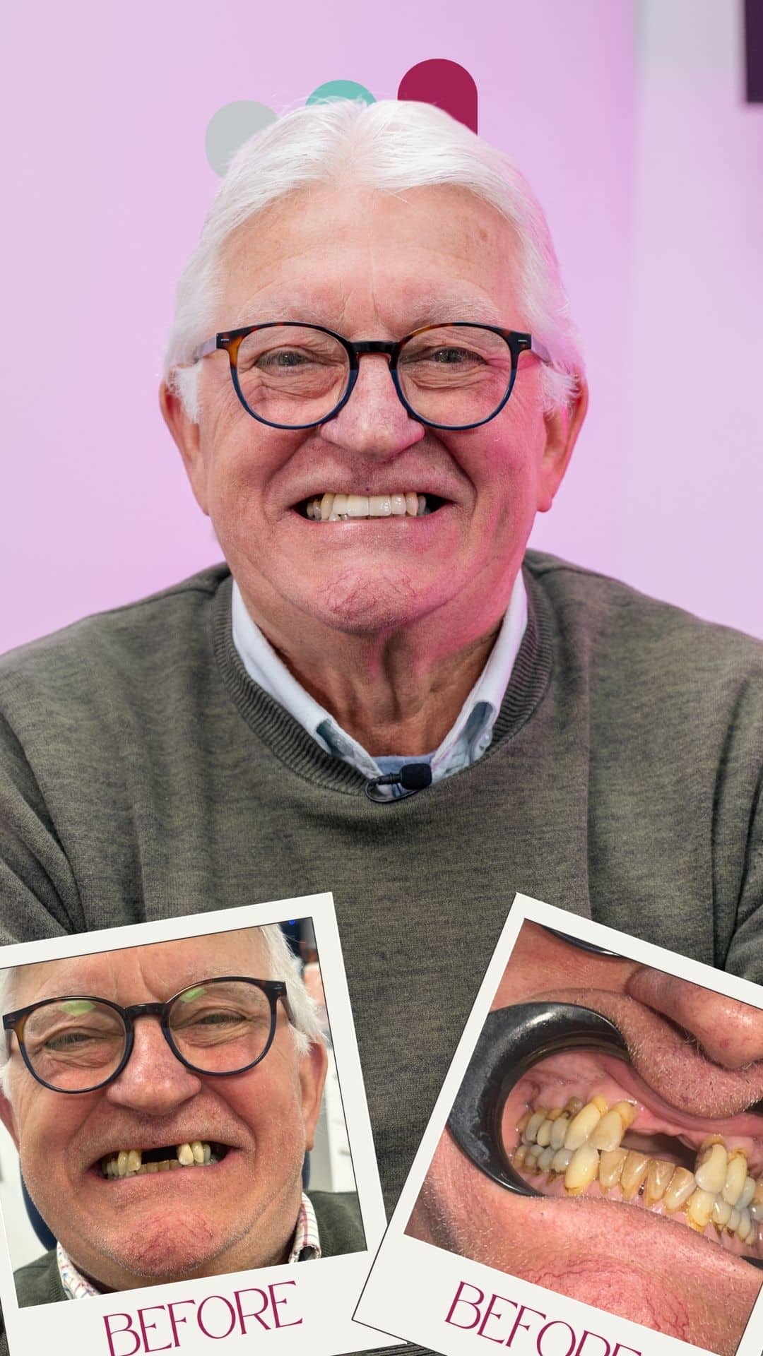 dental implants in CORBY