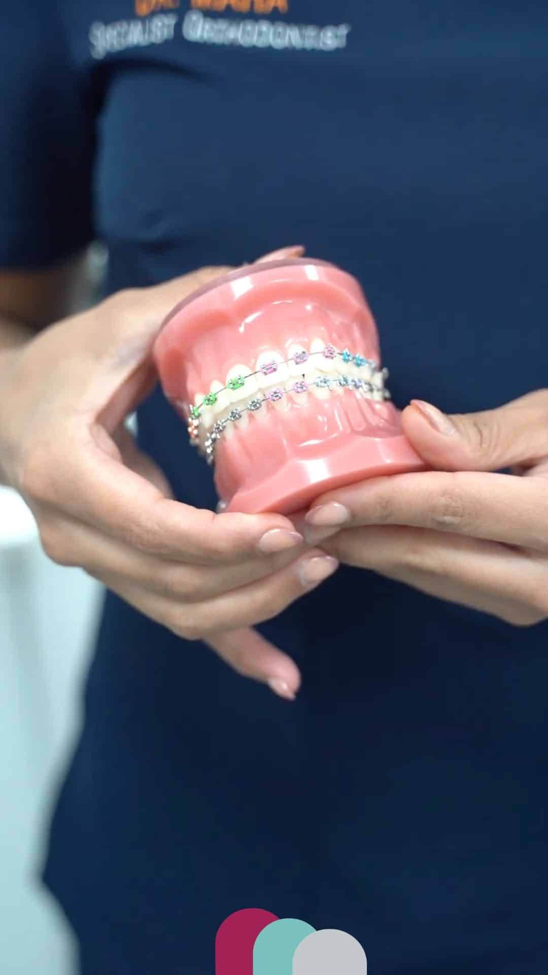veneers in corby