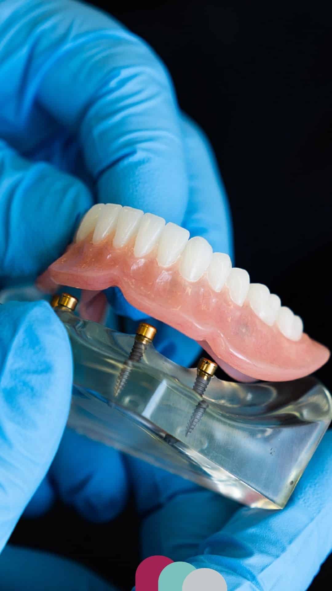 Implants in northamptonshire