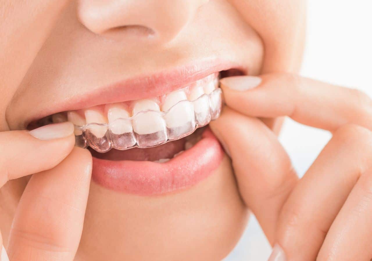 orthodontics in corby
