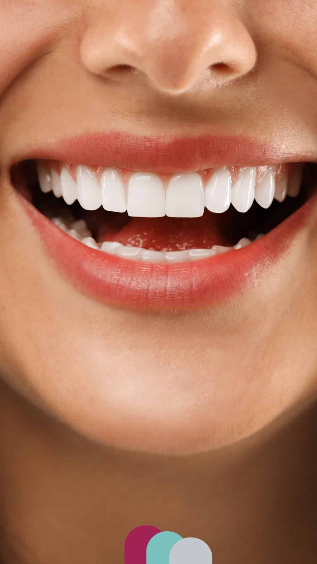 veneers in northampton