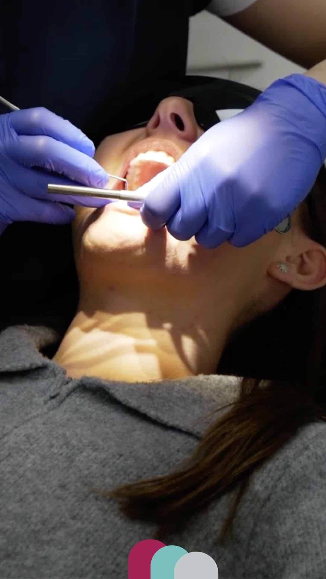 Smile Makeover in northamptonshire