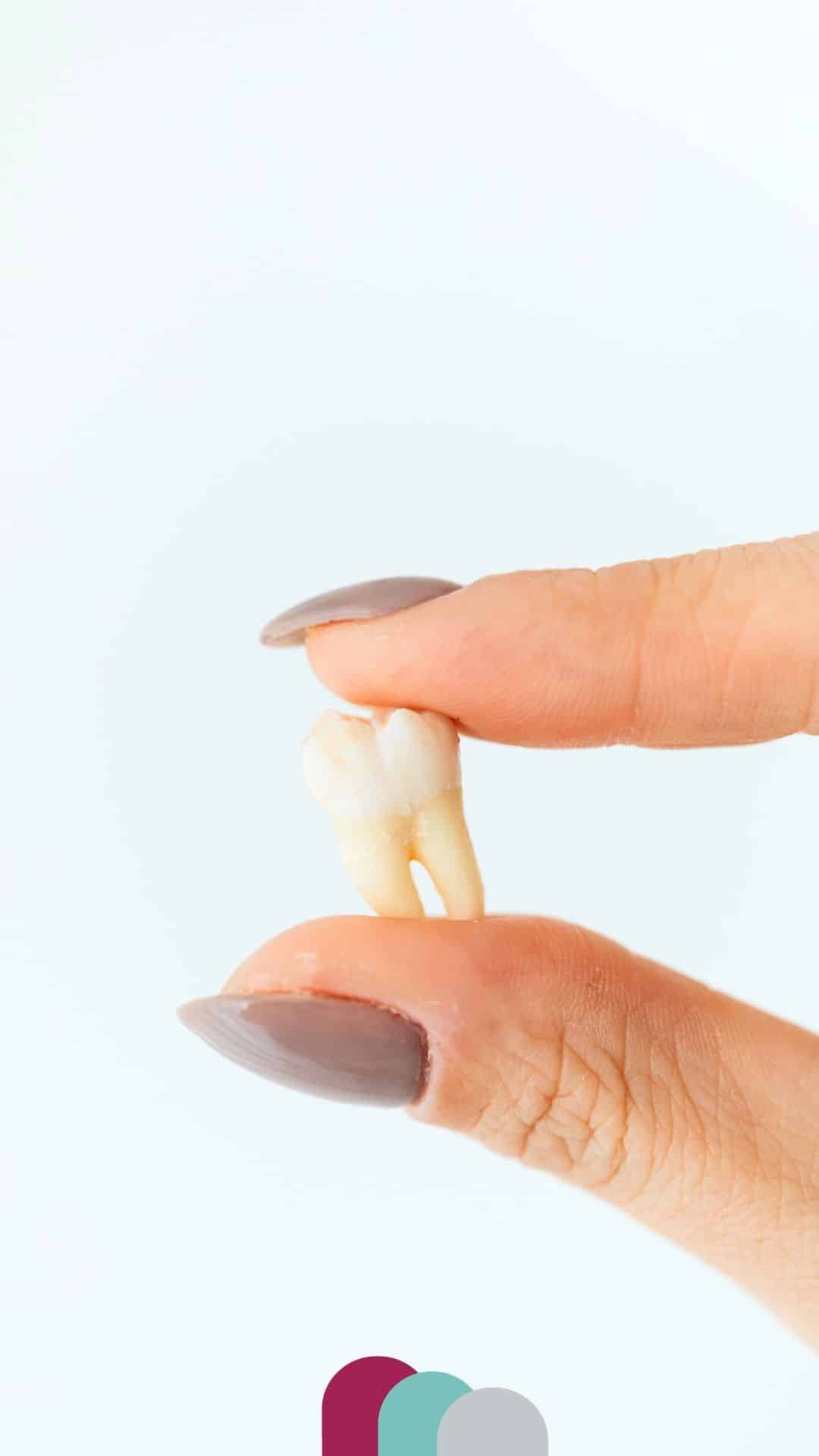 tooth extraction in duston