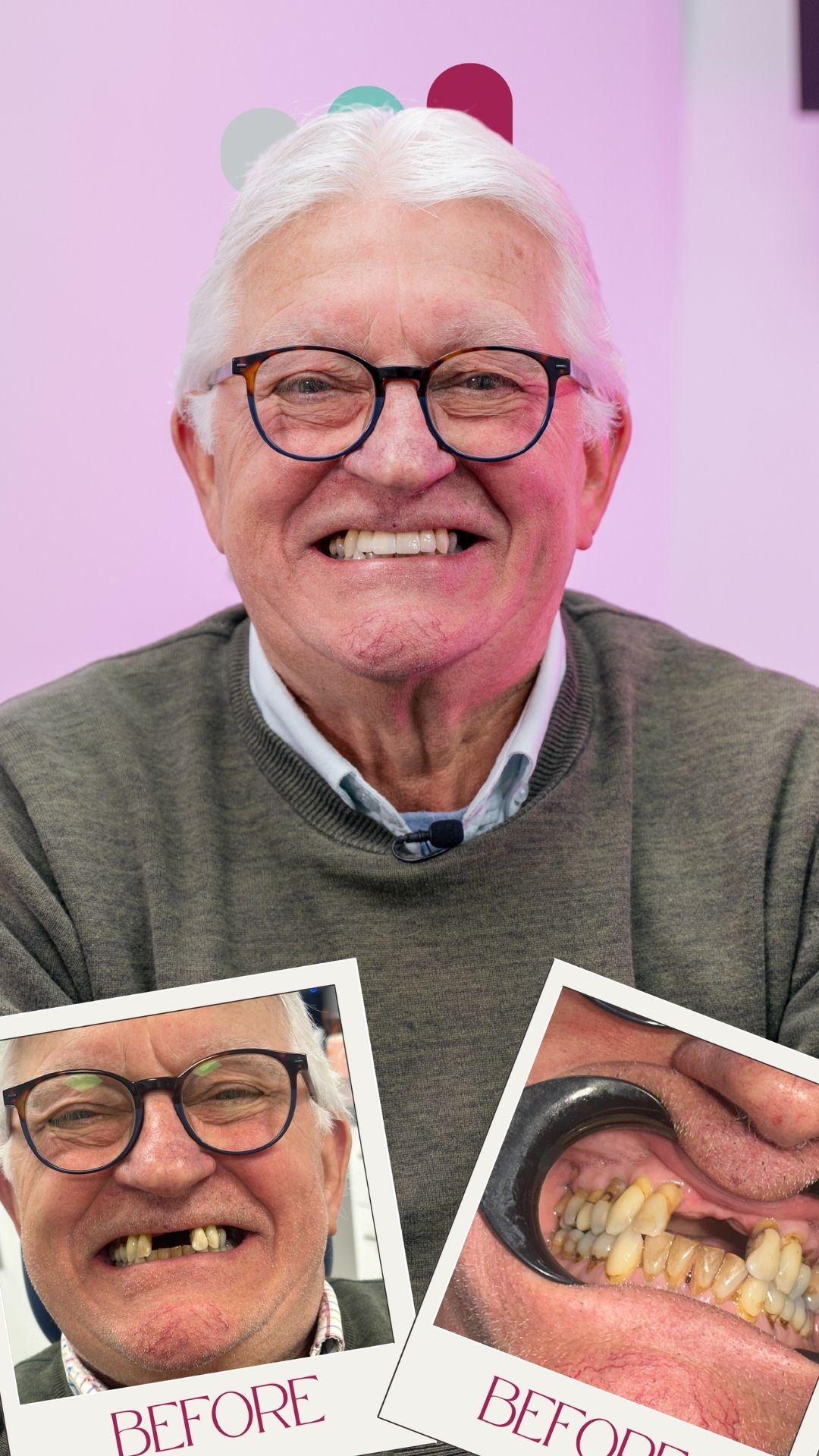 dental implants in thrapston