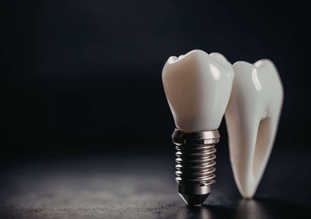 implants in corby
