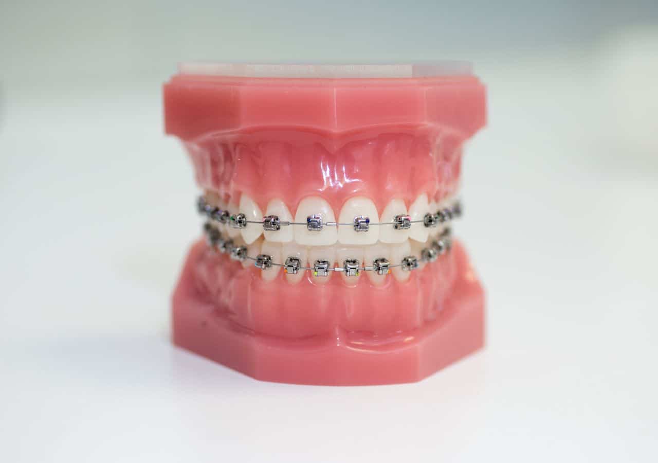 orthodontics in corby