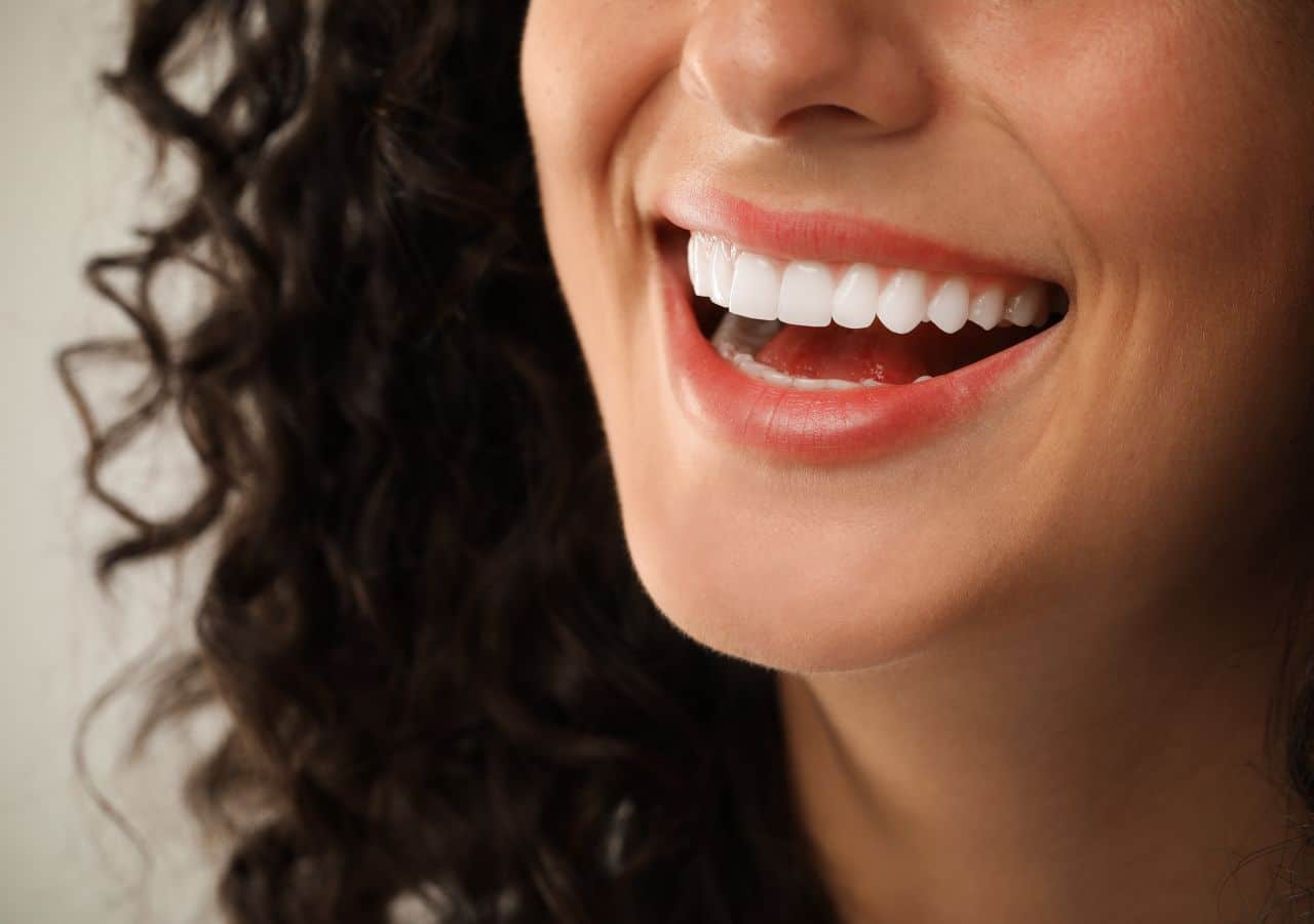 veneers in corby