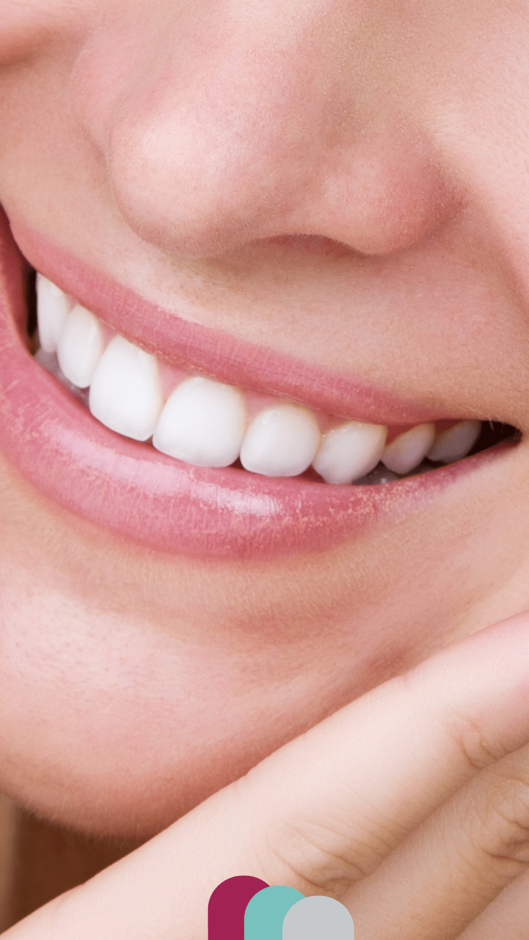veneers in northampton
